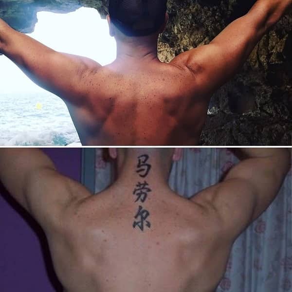 eliminacion tatuaje resultado final