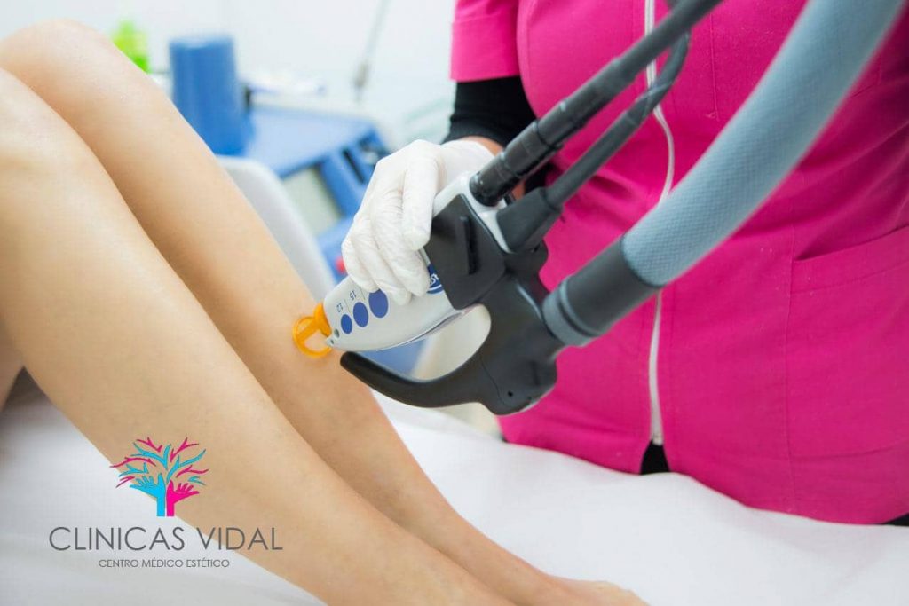 alicante clinicas vidal depilacion laser 