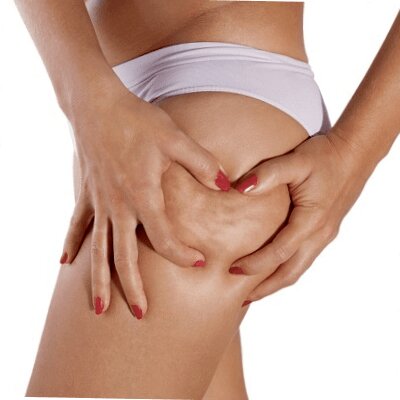 clinicas carboxiterapia barcelona