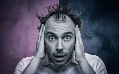 ¿Qué es el shock loss en un trasplante de pelo?