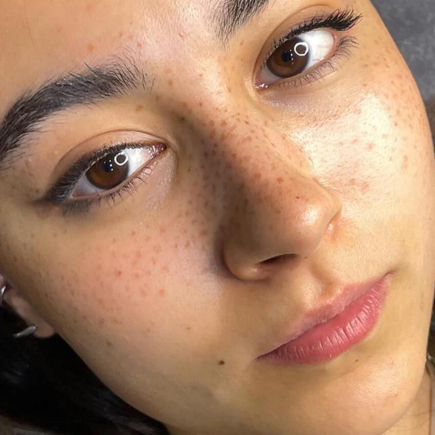 resultados micropigmentacion pecas tricium estudio madrid